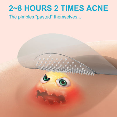 New Micro Needle Hydrocolloid Acne Acne Acne Patch